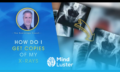 HOW do I GET COPIES of MY X RAYS