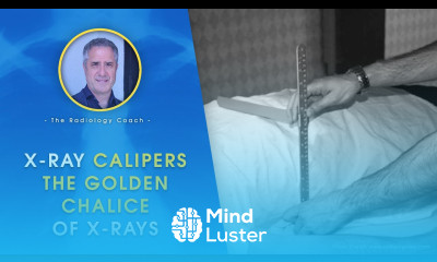 X RAY CALIPERS The Golden Chalice of X rays