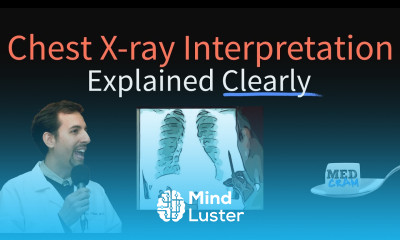 Chest X Ray Interpretation Explained Clearly How to read a CXR