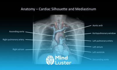 How to Interpret a Chest X Ray Lesson 2 A Systematic Method and Anatomy