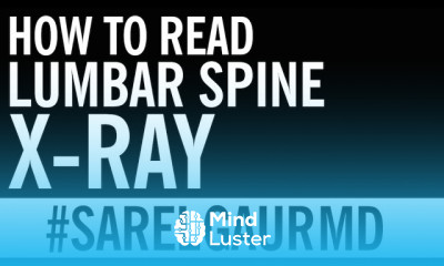 How to Read Lumbar Spine X Ray Search Pattern