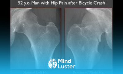 Imaging of the Hip More Radiographic Essentials
