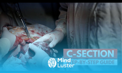 What to expect during a C section Real Footage