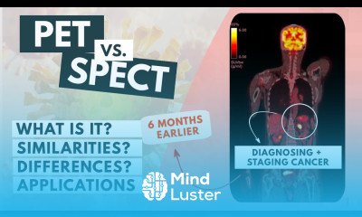 PET vs SPECT The basics Updated video