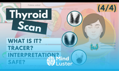 Thyroid Scan Radioactive Iodine Nuclear medicine Visual Explanation