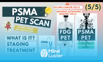What is a PSMA PET scan Overview for Med Students Urology