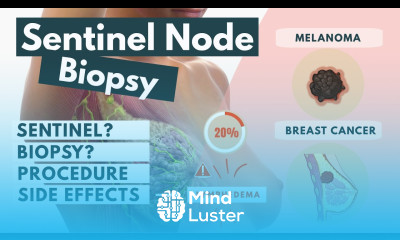 Sentinel Lymph Node Biopsy Procedure Side effects Visual Explanation