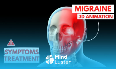 Understanding Migraines Triggers Symptoms and Treatment Options 3D Animation