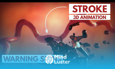How to Recognize a Stroke 3D Animation
