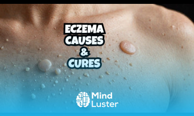 What s the BEST Treatment for Eczema Symptoms