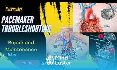 Pacemaker Troubleshooting Pacemaker Bradycardia Unveiled The Heart s Slow