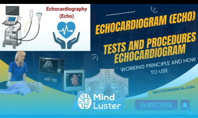 Echocardiogram Echo Basic Transthoracic Echocardiography Tests and Procedures Echocardiogram