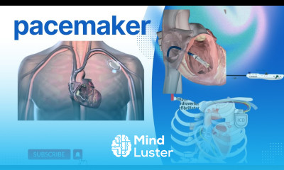An Introduction to Pacemakers Pacemakers Powering Hearts How pacemakers work