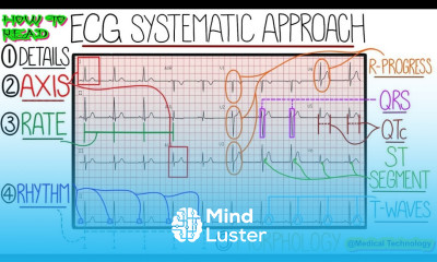 How to Read ECG Report Medical Technology