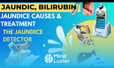 Jaundice Causes Treatment The Jaundice Detector Bilirubin Metabolism Gastrointestinal Pathology