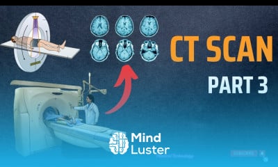 How to Work CT SCAN Medical Technology