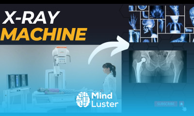 X ray Machine Introduction Medical technology