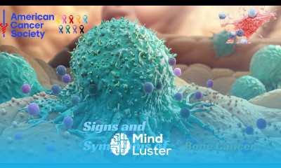 American Cancer Society Spotlighting Silent Signals 20 Overlooked Cancer Symptoms in Men Women