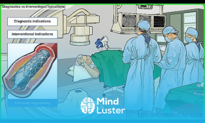 what is cath lab cath lab cath lab procedures cath lab basics cath lab machine view