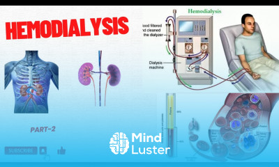 Kidney Failure Hemodialysis What is Dialysis How hemodialysis Works