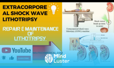 What is Lithotripsy Extracorporeal Shock Wave Lithotripsy procedure of Shockwave Lithotripsy