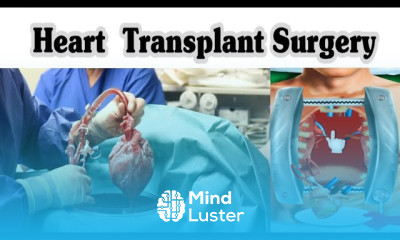 Heart Transplant Surgery 3D Animation