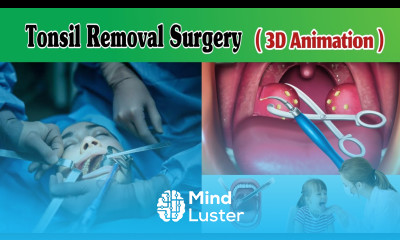 Tonsillectomy Surgery 3D Animation Tonsillitis Surgery Tonsils Operation