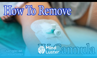 How To Easily Remove IV Cannula IV Cannula Removal