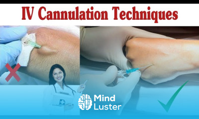 How To Insert IV Cannula IV Cannulation Techniques