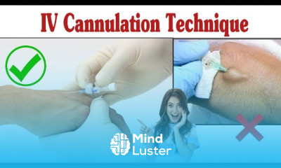 Intravenous Cannulation Technique IV Cannula Procedure
