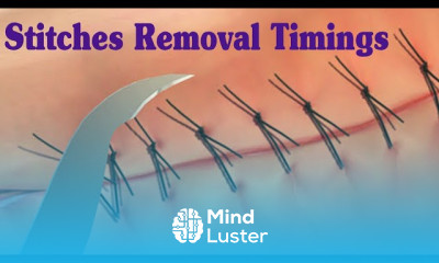 SUTURE REMOVAL TIMINGS Stitches Removel Timings
