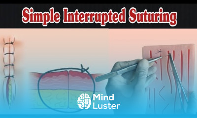 Simple Interrupted Suturing Simple Suture Procedure