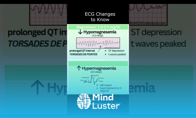 ECG Changes to Know in Electrolyte Imbalances EKG Interpretation Nursing shorts