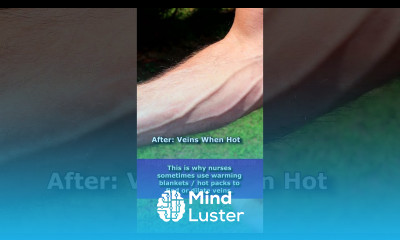 Veins Before and After Popping Out Getting Hot Vasoconstriction vs Vasodilation