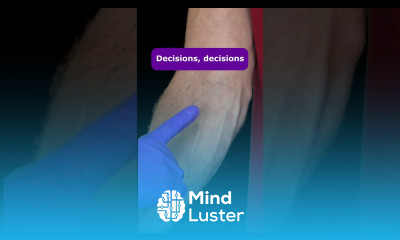 When Nurses See Juicy Veins on a Patient shorts veins