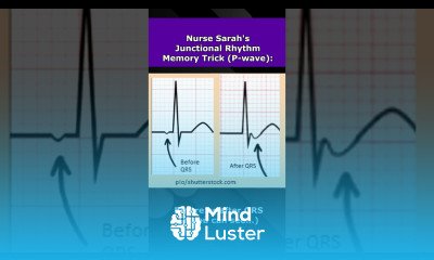 Junctional Rhythms ECG Nursing Mnemonic NCLEX EKG Review