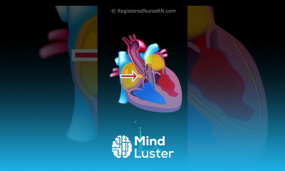 Cardiac Conduction System Electrical Signal Animation with ECG EKG Waveform