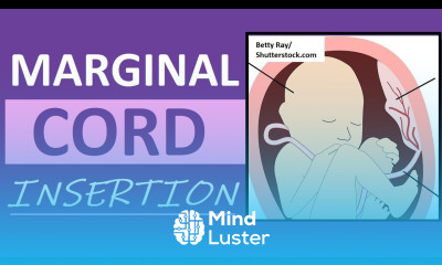 Marginal Cord Insertion Placenta Experience Pregnancy Birth Vlog