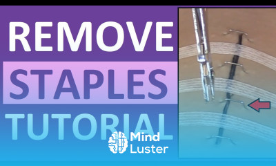 Surgical Staple Removal Nursing How to Remove Surgical Staples