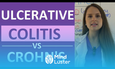 Crohn s Disease vs Ulcerative Colitis Nursing Crohn s vs Colitis Chart Symptoms Treatment