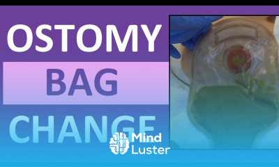 Ostomy Bag Pouch Change Ostomy Care Nursing Colostomy Ileostomy Bag Change