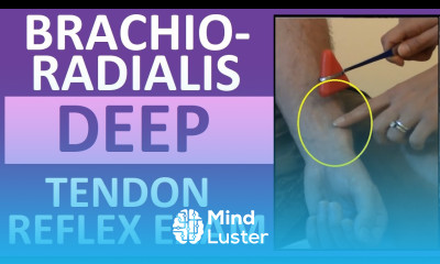 Brachioradialis Deep Tendon Reflex Examination Nursing Head to Toe Assessment