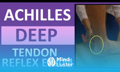 Achilles Heel Deep Tendon Reflex Test Nursing Head to Toe Assessment