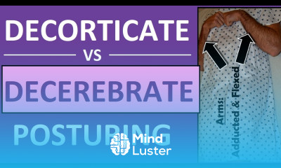 Decerebrate vs Decorticate Posturing Rigidity Mnemonic Pictures Nursing NCLEX