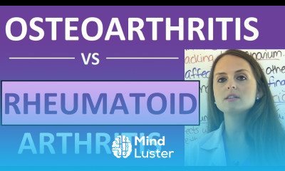 Osteoarthritis vs Rheumatoid Arthritis Nursing Symptoms Pathophysiology Treatment Mnemonic NCLEX