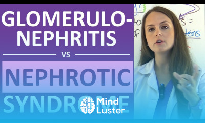 Nephrotic Syndrome vs Glomerulonephritis Nephritic vs Nephrotic Syndrome Nursing NCLEX
