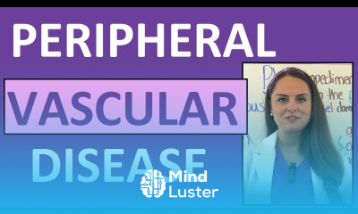 Peripheral Vascular Disease PVD Peripheral Arterial PAD Venous Disease Nursing Treatment Ulcers