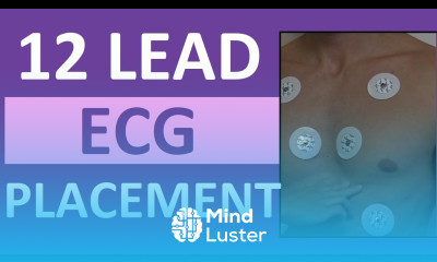 12 Lead ECG Placement of Electrodes EKG Sticker Lead Procedure