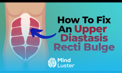 Flatten Upper Abdominal Bulging Upper Diastasis Recti Bulge