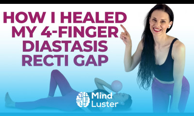 How I Healed My DIASTASIS RECTI belly bulge Diastasis Recti Exercises Mistakes